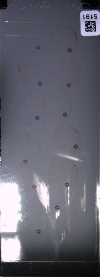 Media type: image; Special Collections 4011   shows specimen_part histological serial section;